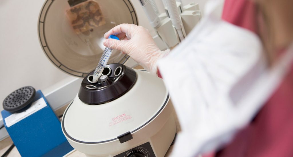 Frozen embryo transfer