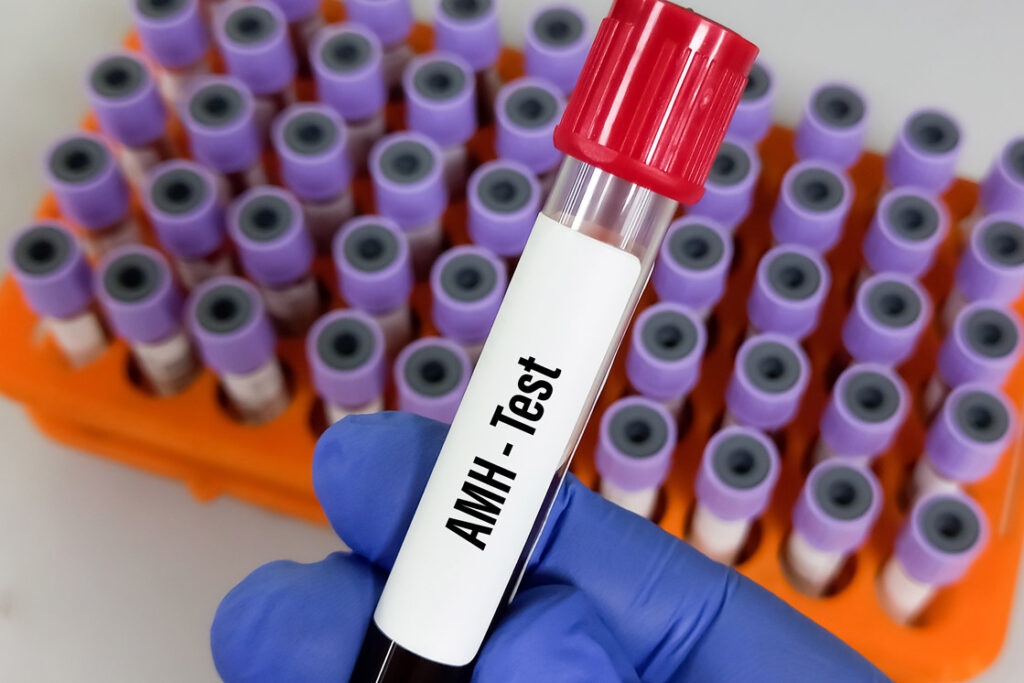 What Is Anti-Mullerian Hormone (AMH)?