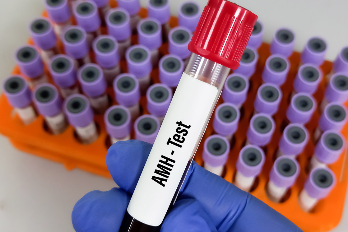 What Is Anti-Mullerian Hormone (AMH)?