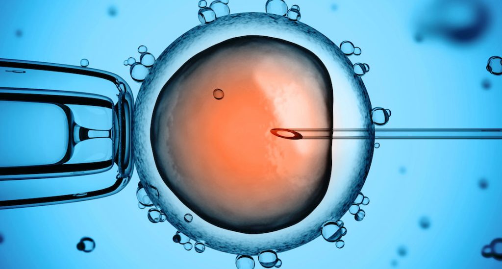 IVF and ICSI