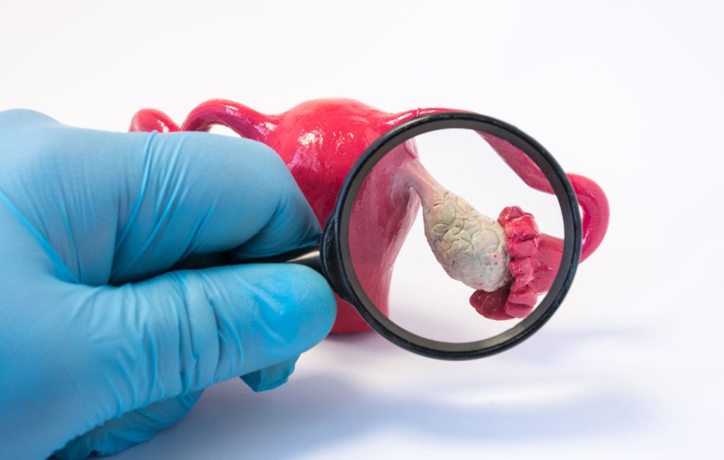 Follicle tracking scan