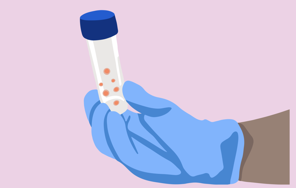 Frozen Embryo Replacement (FER)