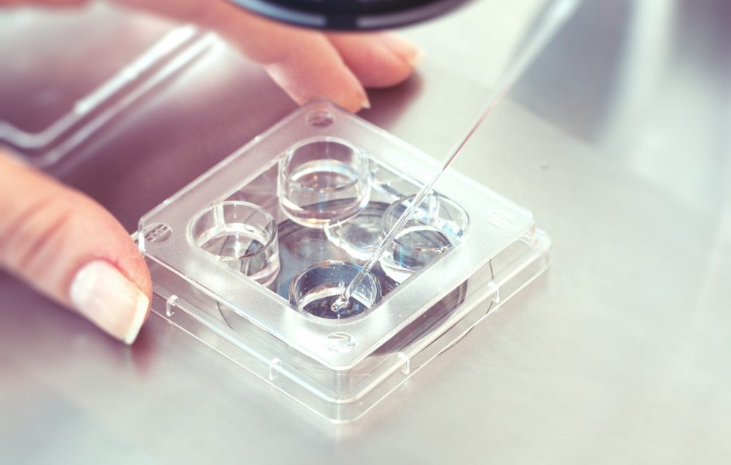 Surgical sperm aspiration (PESA/TESA)