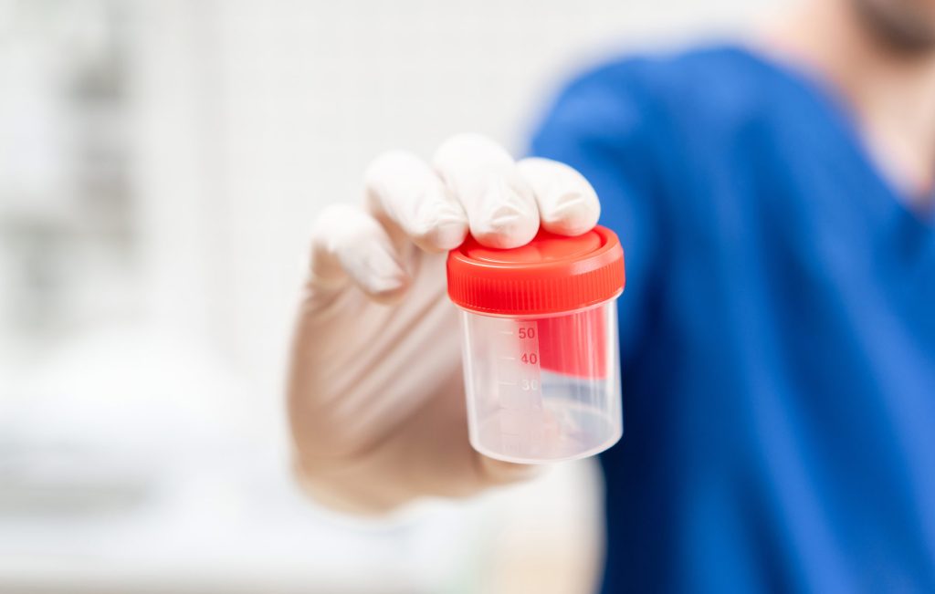 Male fertility tests